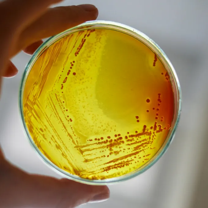 "a petri dish being held by a human"